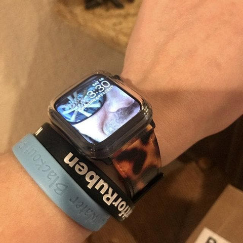 Shop The Grunge Tortoise Shell Apple Watch Band Exclusively at The Urban Flair - Trendy Faux/Vegan Leather iWatch Straps - Affordable Replacements Bands For Women